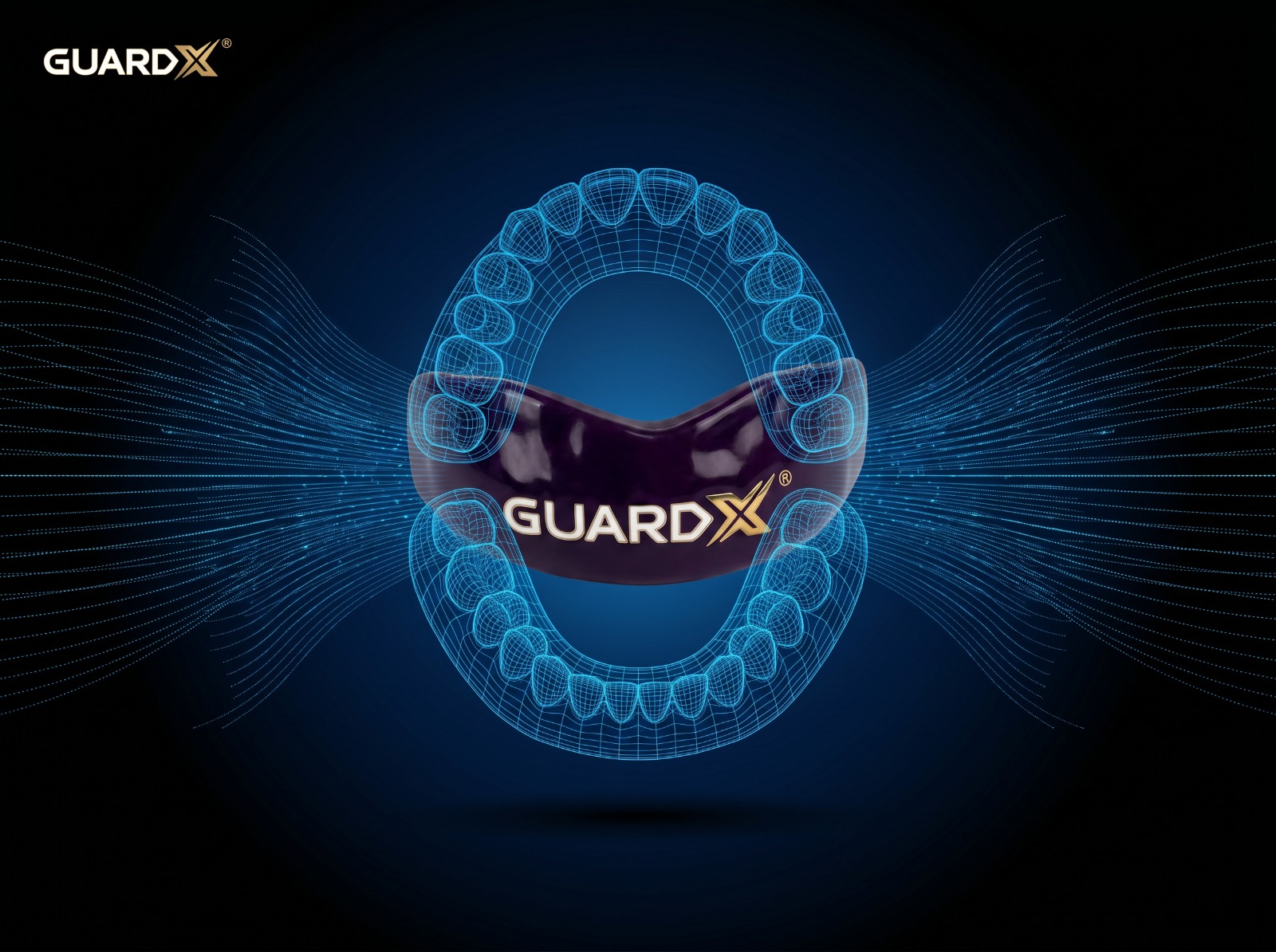 Arcada dentária escaneada em 3D com protetor GuardX